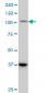 STAT2 Antibody (monoclonal) (M01)