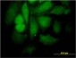 STAT4 Antibody (monoclonal) (M01)