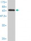 STAT5B Antibody (monoclonal) (M01)