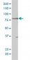 STAT5B Antibody (monoclonal) (M01)