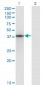 STAT5B Antibody (monoclonal) (M01)