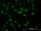 STAT5B Antibody (monoclonal) (M03)