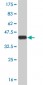 STAT5B Antibody (monoclonal) (M03)