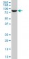 STAT5B Antibody (monoclonal) (M03)