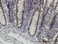 STAT6 Antibody (monoclonal) (M01)