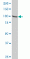 STAT6 Antibody (monoclonal) (M01)