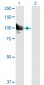 STAT6 Antibody (monoclonal) (M01)