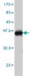 STC1 Antibody (monoclonal) (M01)