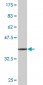 STCH Antibody (monoclonal) (M02)