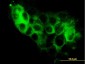 STEAP1 Antibody (monoclonal) (M01)