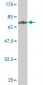 STEAP1 Antibody (monoclonal) (M01)