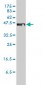 STEAP1 Antibody (monoclonal) (M01)