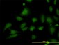 STIM1 Antibody (monoclonal) (M01)