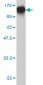 STIM1 Antibody (monoclonal) (M01)