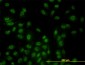 STK17B Antibody (monoclonal) (M01)