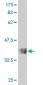 STK32C Antibody (monoclonal) (M02)