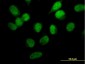 STK33 Antibody (monoclonal) (M02)