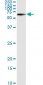 STK33 Antibody (monoclonal) (M02)