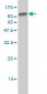 STK33 Antibody (monoclonal) (M02)