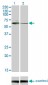 STK33 Antibody (monoclonal) (M02)