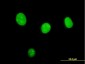 STK33 Antibody (monoclonal) (M03)