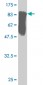 STK33 Antibody (monoclonal) (M03)