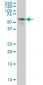 STK33 Antibody (monoclonal) (M03)