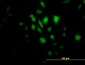 STK33 Antibody (monoclonal) (M07)