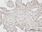 STK33 Antibody (monoclonal) (M07)