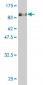 STK33 Antibody (monoclonal) (M07)