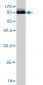 STK33 Antibody (monoclonal) (M09)