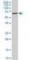 STK33 Antibody (monoclonal) (M09)