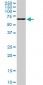 STK33 Antibody (monoclonal) (M09)