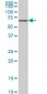 STK33 Antibody (monoclonal) (M09)