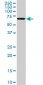 STK33 Antibody (monoclonal) (M09)