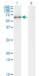 STK33 Antibody (monoclonal) (M09)