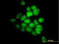 STK33 Antibody (monoclonal) (M09)