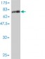 STK38 Antibody (monoclonal) (M01)