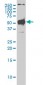 STK38 Antibody (monoclonal) (M01)