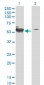 STK38 Antibody (monoclonal) (M01)