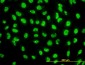 STK38 Antibody (monoclonal) (M01)