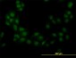 STK38 Antibody (monoclonal) (M11)