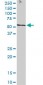 STK38 Antibody (monoclonal) (M11)