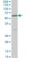 STK38 Antibody (monoclonal) (M11)