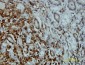 STK4 Antibody (monoclonal) (M01)