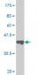 SUPT16H Antibody (monoclonal) (M01)