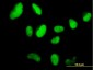 SUPT5H Antibody (monoclonal) (M03)