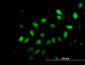 SURB7 Antibody (monoclonal) (M03)