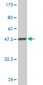 SURB7 Antibody (monoclonal) (M03)