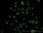 SURB7 Antibody (monoclonal) (M04)